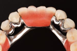 Partial dentures